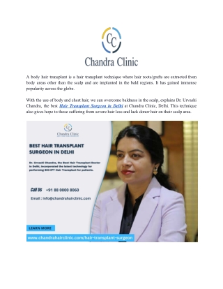 Best Hair Transplant Surgeon in Delhi at Chandra Clinic
