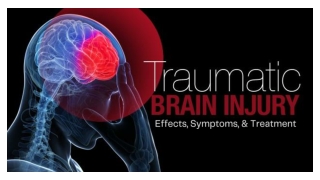 Dushyant Verma - Traumatic Brain Injury - Effects, Symptoms, and Treatment.