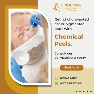 Get rid of unwanted scars with Chemical Peels - Epiderma Skin Clinic Jayanagar