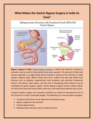 What Makes the Gastric Bypass Surgery in India So Easy