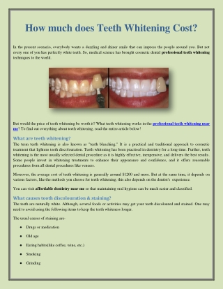 How much does Teeth Whitening Cost?