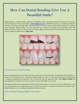 How Can Dental Bonding Give You A Beautiful Smile?