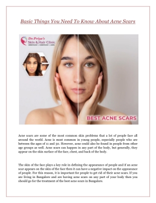 Basic Things You Need To Know About Acne Scars