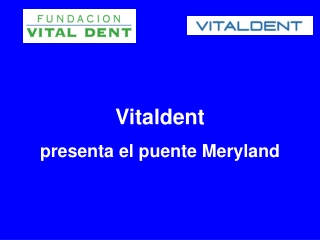 Vitaldent presenta el puente Meryland