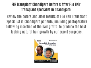 FUE Transplant Chandigarh Before & After Fue Hair Transplant Specialist in Chandigarh