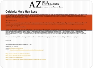 Celebrity Male Hair Loss