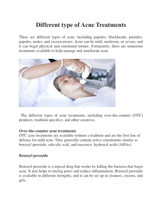 Different type of Acne Treatments