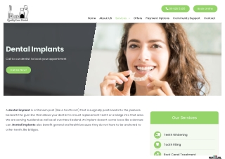 The Benefits of Choosing Dental Implant Treatment in Auckland