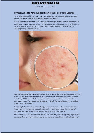 Putting An End to Acne: Medical Spa Acne Clinic For Your Benefits