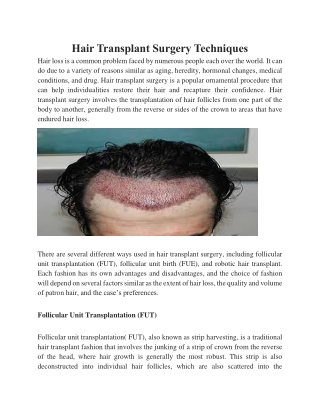 Hair Transplant Surgery Techniques