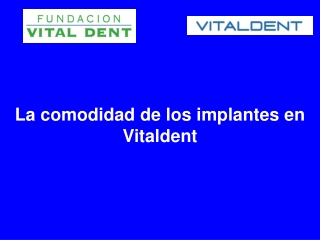 La comodidad de los implantes en Vitaldent