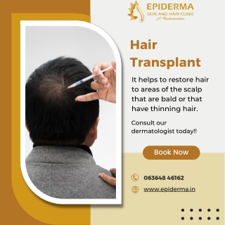 Hair Transplant | Best Hair Clinic in Jayanagar, Bangalore | Epiderma Clinic