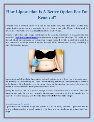 How Liposuction Is A Better Option For Fat Removal?
