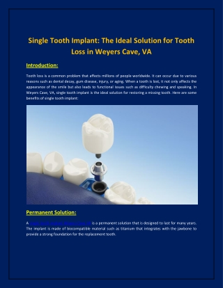 Single Tooth Implant: The Ideal Solution for Tooth Loss in Weyers Cave, VA