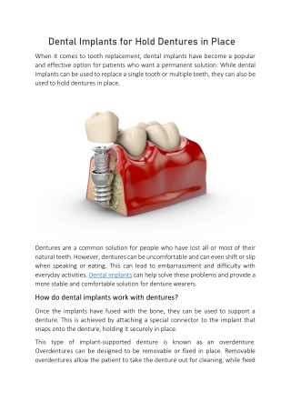 Dental Implants for Hold Dentures in Place