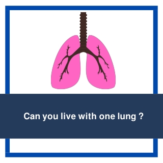 Can you live with one lung  Best Lung Cancer Doctor in Bangalore  Dr. Murali Subramanian