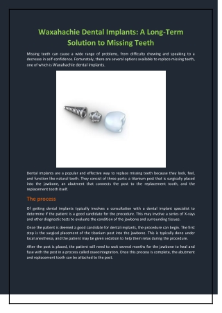 Waxahachie Dental Implants: A Long-Term Solution to Missing Teeth