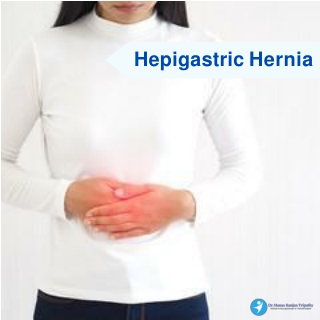 Epigastric Hernia,Best Proctologist In HSR Layout  Dr Manas Tripathy (2)