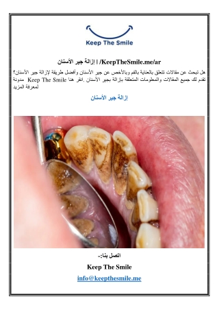 إزالة جير الأسنان | /KeepTheSmile.me/ar