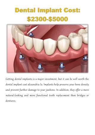 Dental Implant Cost: $2300-$5000