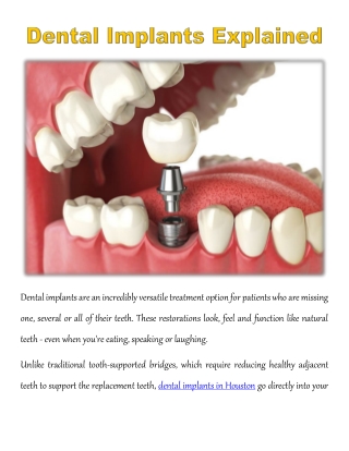 Dental Implants Explained