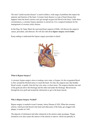 _Understanding Bypass Surgery_ What to Expect