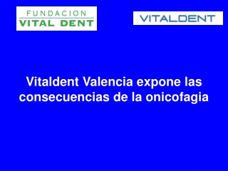 Clinicas vitaldent valdemoro los efectos de la onicofagia