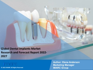 Dental Implants Market Industry Overview, Growth Rate and Forecast 2022-2027