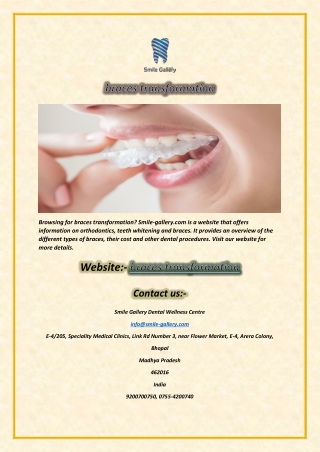 braces transformation