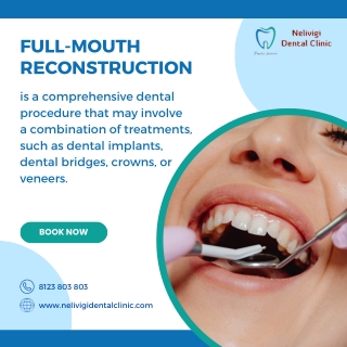 Full Mouth Reconstruction - Best Dental Clinic in Bellandur - Nelivigi Dental