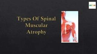 Spinal Muscular Atrophy Types