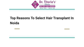 Top Reasons To Select Hair Transplant In Noida