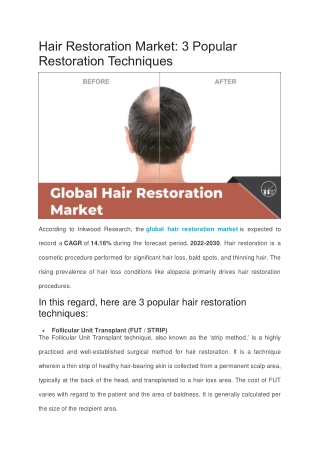 Hair Restoration Market: 3 Popular Restoration Techniques