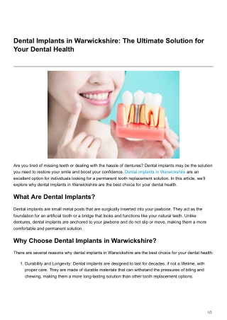 Dental Implants in Warwickshire The Ultimate Solution for Your Dental Health