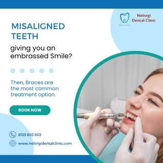 How to fix Misaligned Teeth | Best Dental Clinic in Bellandur | Nelivigi Dental