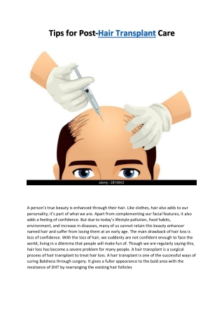 How to take care of your hair after a hair transplant