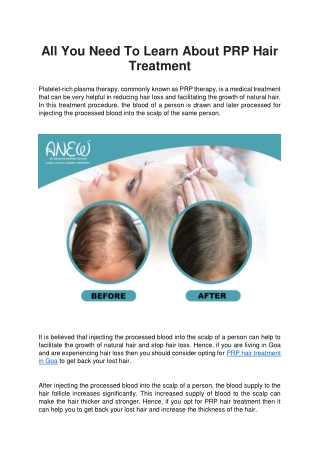All You Need To Learn About PRP Hair Treatment - ANEW