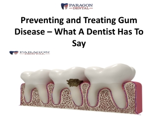 Preventing and Treating Gum Disease – What A Dentist Has To Say