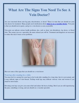 What Are The Signs You Need To See A Vein Doctor?