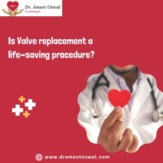 Is Valve replacement major surgery,  Best Heart Specialist in Basavanagudi,  Dr. Ameet Oswal