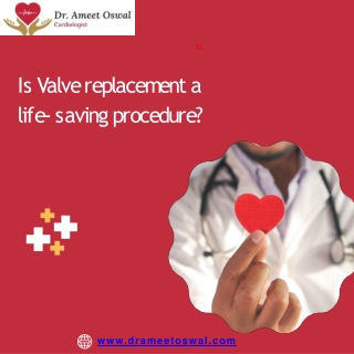 Is Valve replacement major surgery,  Best Heart Specialist in Basavanagudi,  Dr. Ameet Oswal