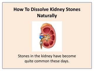 Stonil Natural Treatment for Kidney Stones