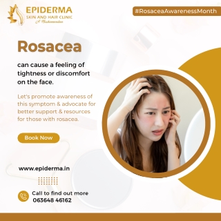 Rosacea Causes | Best Dermatology Centre in Jayanagar | Epiderma Clinic