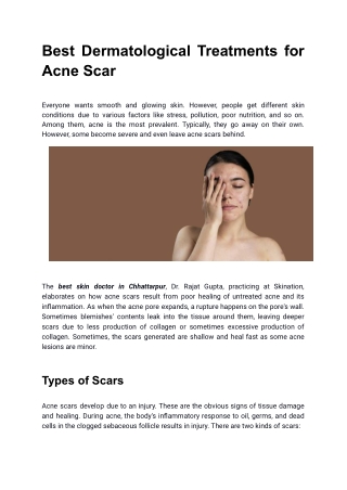 Best Dermatological Treatments for Acne Scar