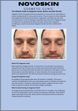 The Ultimate Guide to Oxygeneo Facials: Before and After Results