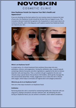 How OxyGeneo Facials Can Improve Your Skin's Health and Appearance?