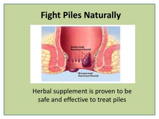 Herbal Treatment for Hemorrhoids and Bleeding Piles