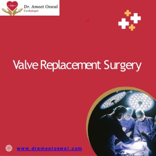 Valve replacement surgery, Best Cardiologist in Basavanagudi,  Dr. Ameet Oswal