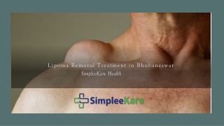 Lipoma Removal Treatment in Bhubaneswar simpleekare health