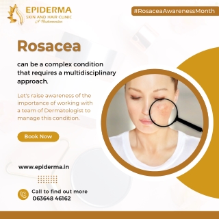 Know about Rosacea | Best Dermatology Centre in Jayanagar | Epiderma Clinic